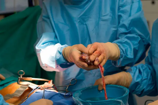 People conducting kidney surgery