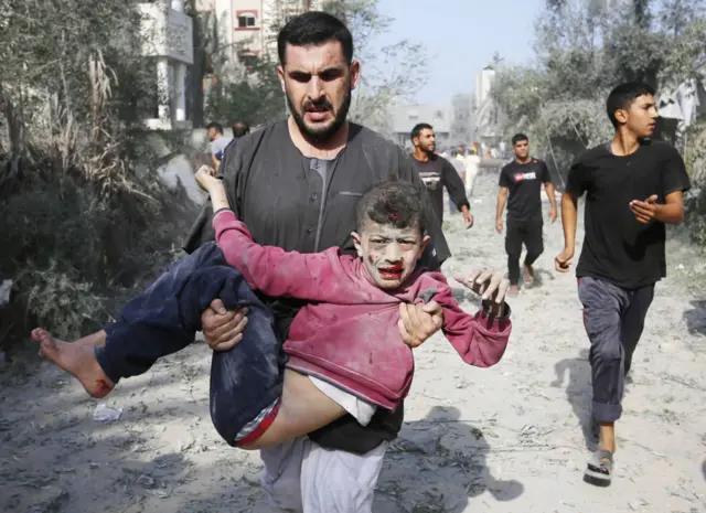 An injured child is carried away from the site of an explosion in the Gazan city of Deir al-Balah. He is around 12 or 13 years old. His face is covered in dust and blood.