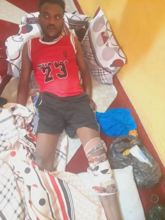 Abdi Tufa, 25, broke his leg when he jumped from a slow-moving bus to rescue a 10-year-old boy who had been trapped in a flood in the small town of Hirna, 350km (217 miles) east of Addis Ababa