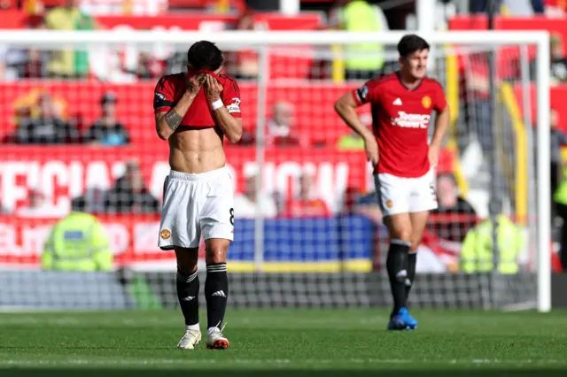 Fernandes covers his face with his shirt, Maguire stands with his hands on his hips.