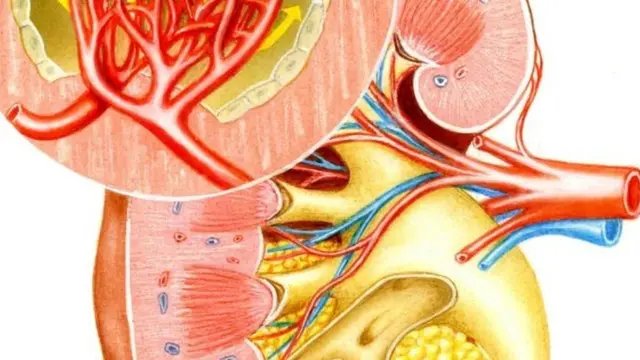 Kidney in cut-away view with a close-up on the glomerulus. At the extremity of each nephron there is the renal glomerulus, filtration unit of the kidney