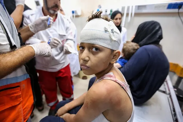 Palestinians injured in Israeli air raids are treated at Nasser Medical Hospital