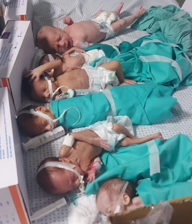 Six premature newborn babies on an adult hosptial bed