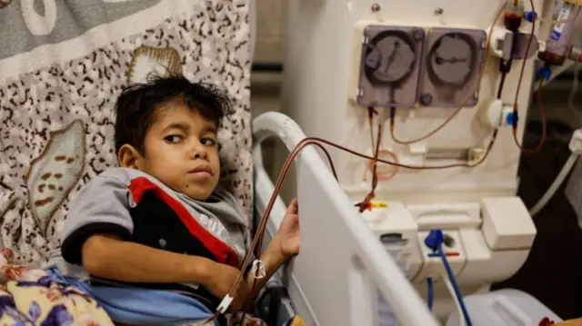 A Palestinian kidney patient lies on a hospital bed, as health officials say they are running out of fuel to operate dialysis devices