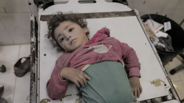 Young girl lies on hospital trolley with ash covering her face