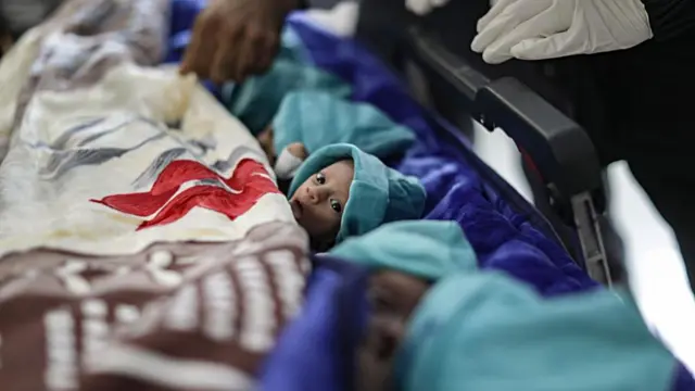 A premature baby looks, with wide eyes, towards the camera. It lies next to others, who are also covered in blankets