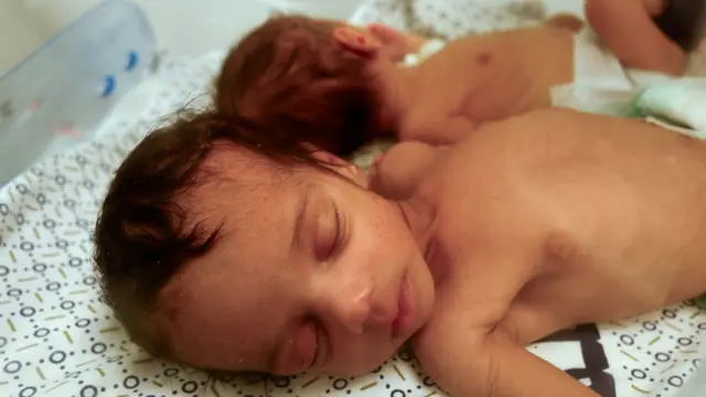 Two babies lay sleeping in incubator