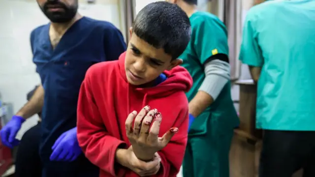 A wounded boy holds his arm