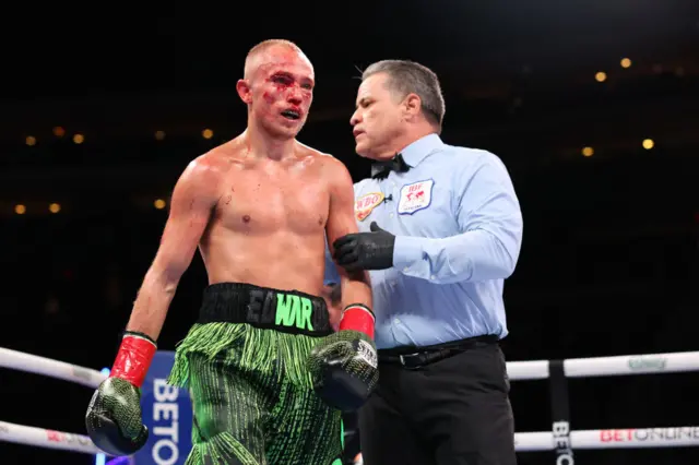 Sunny edwards is bloodied and held by the referee