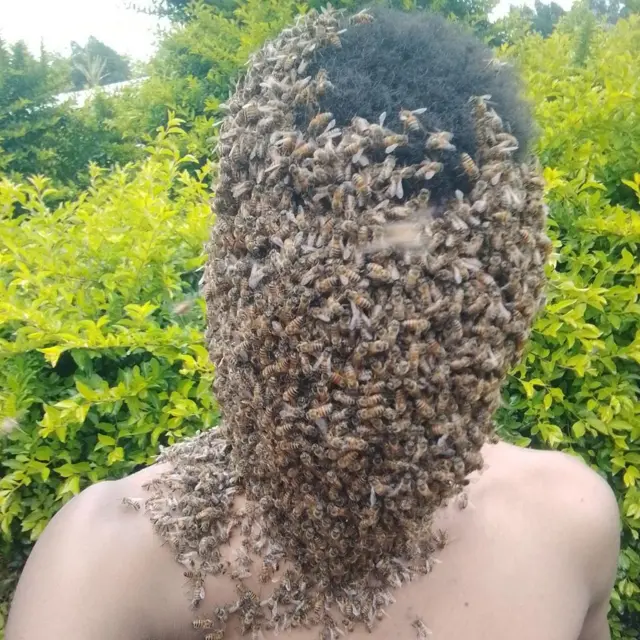 Honey bees swarming Tamirat Getachew's head and torso.