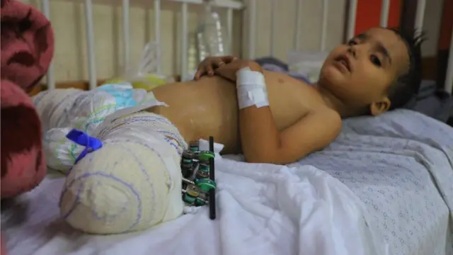 Three-year-old Ahmed Shabat in hospital