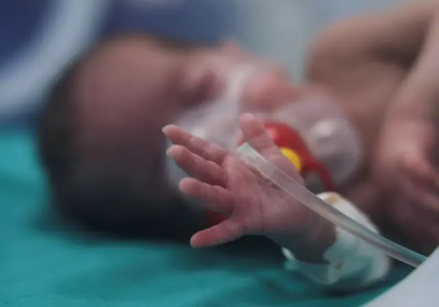 Palestinian baby at Cairo hospital