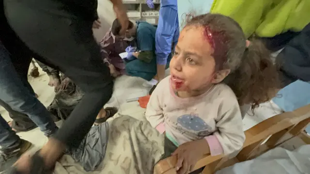 A Palestinian girl wounded in Israeli strikes waits to be assisted at Nasser hospital in Khan Younis, 7 December 2023