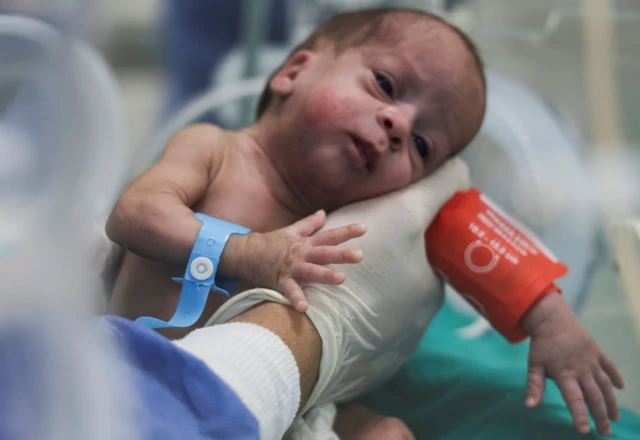 A doctor holds a premature Palestinian baby