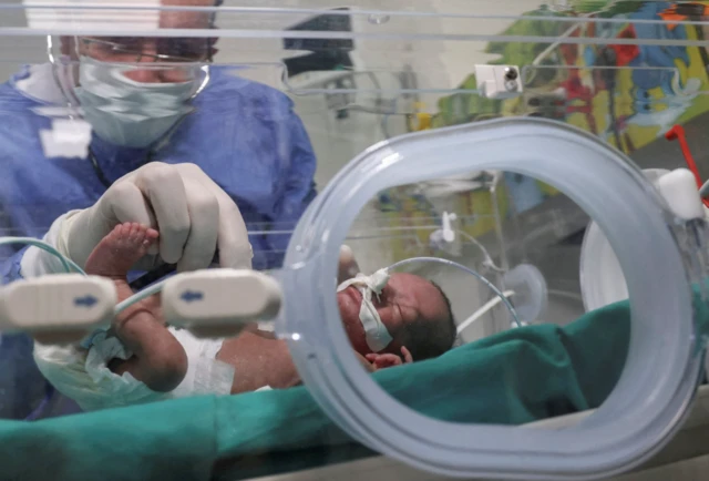 A premature Palestinian baby evacuated from Gaza receives treatment at in eastern Cairo