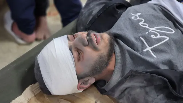 A wounded man lies in a Gaza hospital