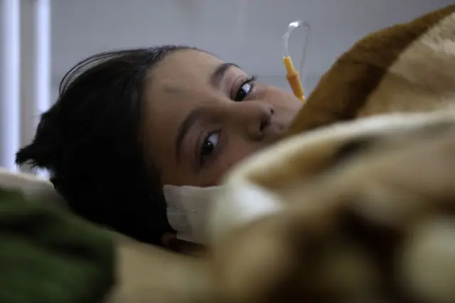 A child injured in a deadly earthquake lies in a bed at a hospital in Afrin in Syria's rebel-held part of Aleppo province, on February 9, 2023. - The 7.8-magnitude quake early on February 6 has killed more than 17,000 people in Turkey and war-ravaged Syria, according to officials and medics in the two countries, flattening entire neighbourhoods. (Photo by Bakr ALKASEM / AFP) (Photo by BAKR ALKASEM/AFP via Getty Images)