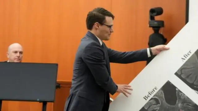 Gwyneth Paltrow attorney James Egan displays a poster showing a brain scan in the courtroom in Park City, Utah, USA 29 March 2023