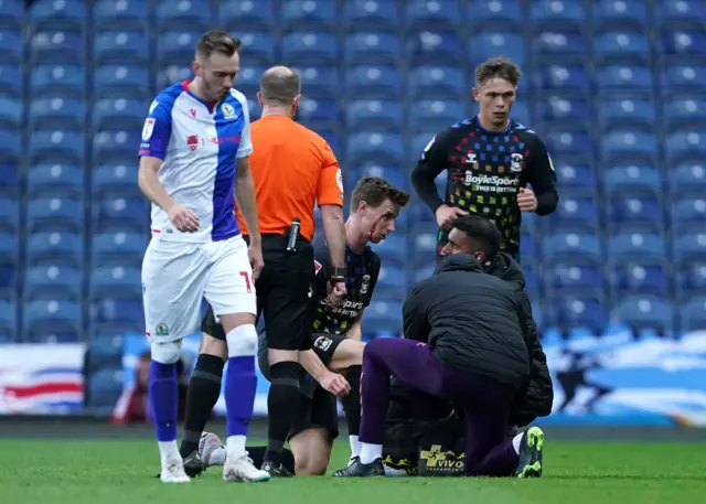 Coventry's Ben Sheaf has treatment for a cut near his eye