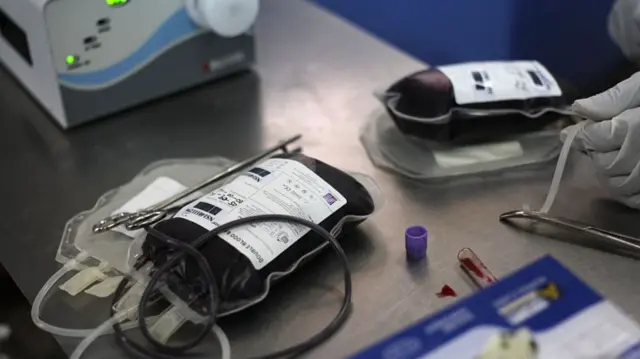 Bags of donated blood are pictured at Korle Bu hospital's blood centre on September 5, 2014 in Accra, Ghana.