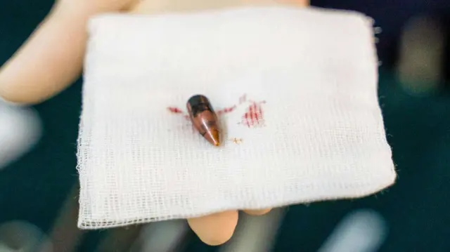 A bullet removed from a wounded person