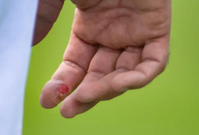 Finger