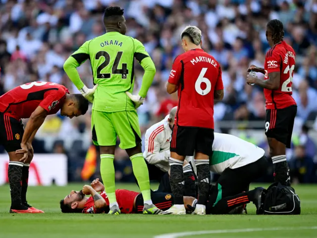 Fernandes lies injured surrounded by concerned teammates.