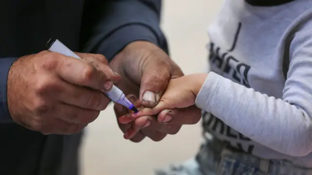 A close up of an adult's hands marking a child's fingernail with a purple pen.