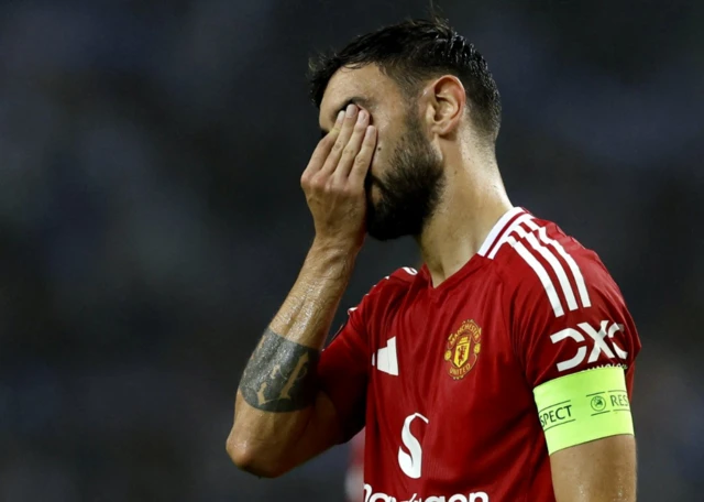 Bruno Fernandes looks dejected