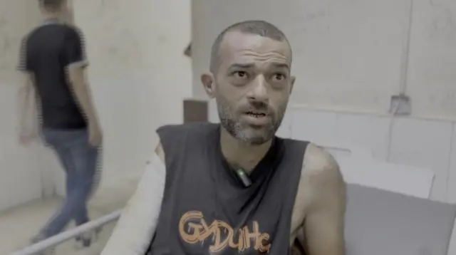 Ahmed Younis, wearing a vest shirt and with his arm in a cast, looks at the camera