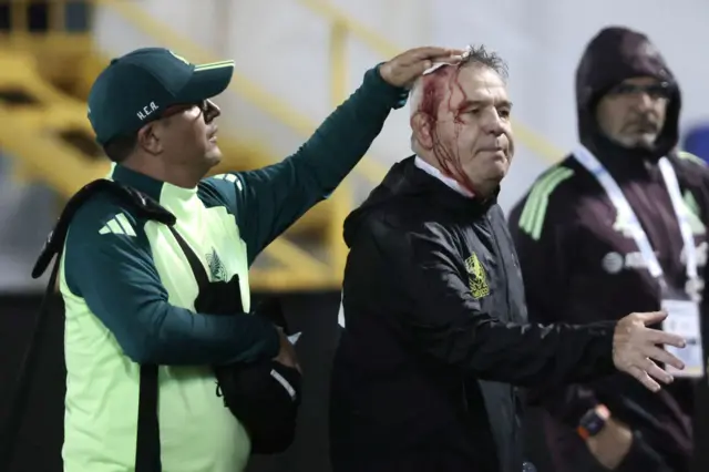 Javier Aguirre receives treatment after being hit by a full can of beer
