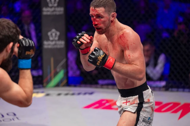 Blood pours from Brendan Loughnane's face