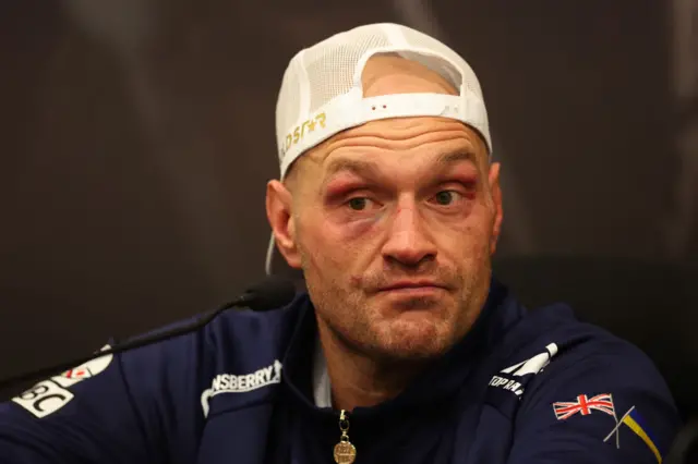 Tyson Fury with a bruised face