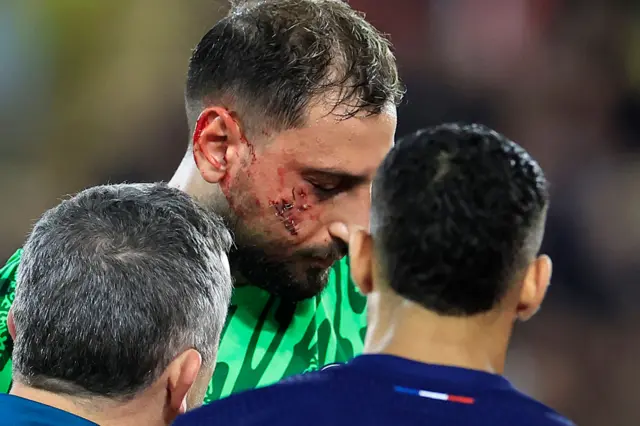 Gianluigi Donnarumma after receiving treatment on a facial injury