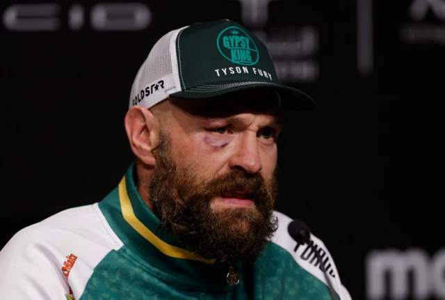 Tyson Fury battered and bruised speaks at a news conference