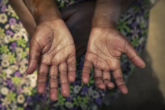 Palms of hands asking for help in Uganda.