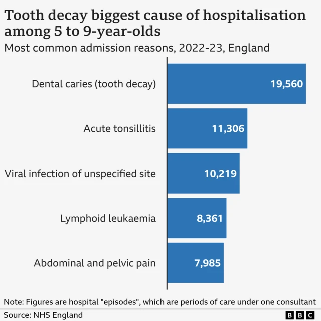 A chart showing the most common reasons for hospital admissions in 2022-23. Dental caries (tooth decay) is at the top with 19,560