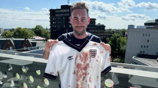 England fan Babac holding a blood-stained England jersey