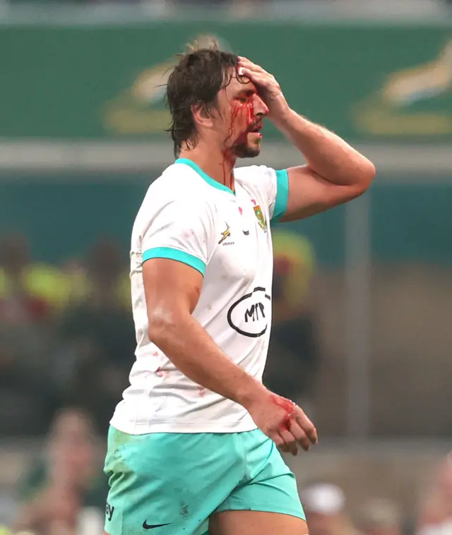 Eben Etzebeth