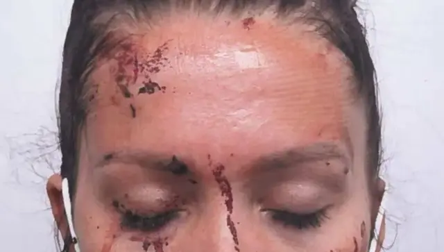 Kiena Dawes with black hair tied back and eyes close wearing headphones with cuts on her forehead and blood covering her face