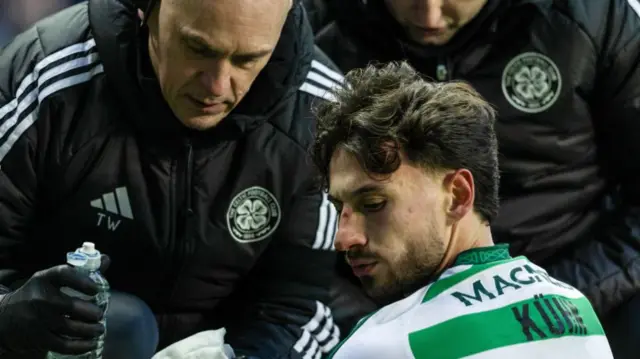 GLASGOW, SCOTLAND - JANUARY 02: Celtic's Nicolas Kuhn is treated for a facial injury during a William Hill Premiership match between Rangers and Celtic at Ibrox Stadium, on January 02, 2025, in Glasgow, Scotland.  (Photo by Craig Foy / SNS Group)