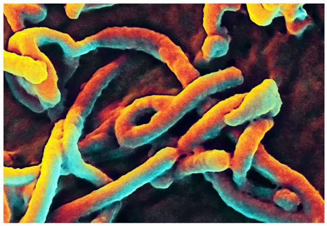 Produced by the National Institute of Allergy and Infectious Diseases (NIAID), under a very-high magnification, this digitally-colourized scanning electron micrograph (SEM) depicts filamentous Ebola virus particles budding from the surface of a VERO cell of the African green monkey kidney epithelial cell line