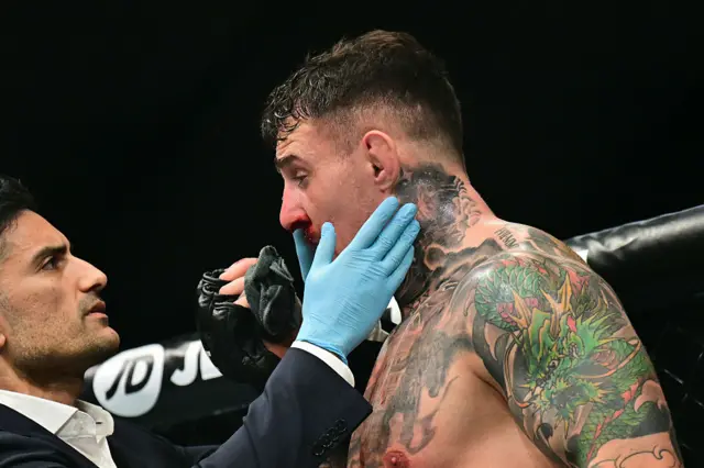Tom Aspinall's eyes are checked by a doctor