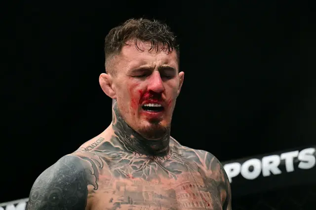 Tom Aspinall with blood on his face after the eye poke