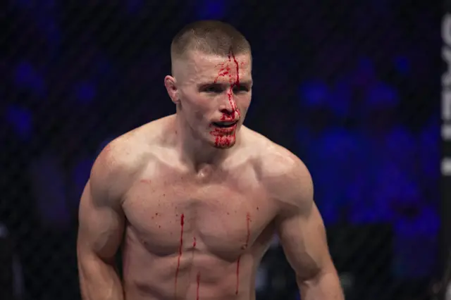 Paul Hughes with blood running down his face