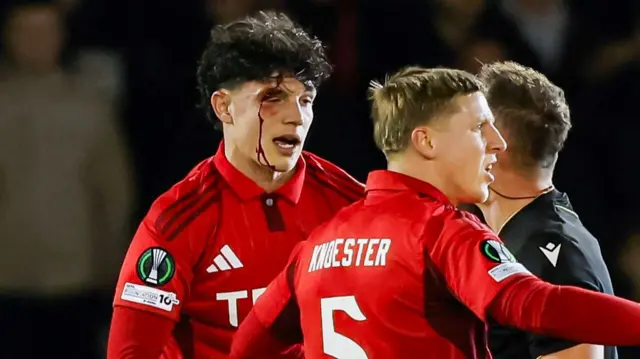 Blood drips down the face of Jack Milne after an elbow