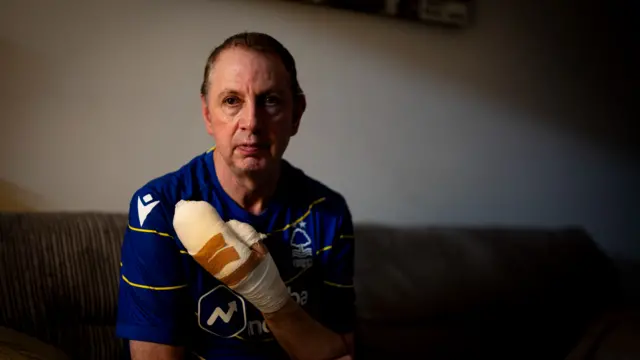 Crean holding up his left hand which is heavily bandaged