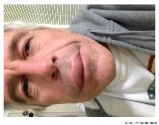 A close-up selfie of Epstein which appears to show his lips swollen
