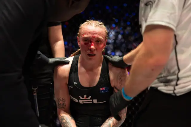 Sara Collins face is bloody and swollen