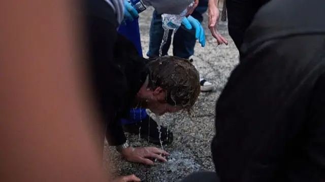 Një burrë me katër këmbë në këmbë i derdhen ujë në sy